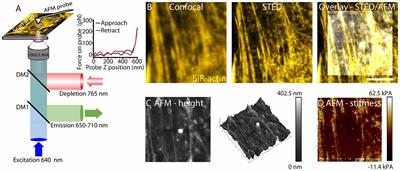 Correlative STED and Atomic Force Microscopy on Live Astrocytes Reveals Plasticity of Cytoskeletal Structure and Membrane Physical Properties during Polarized Migration